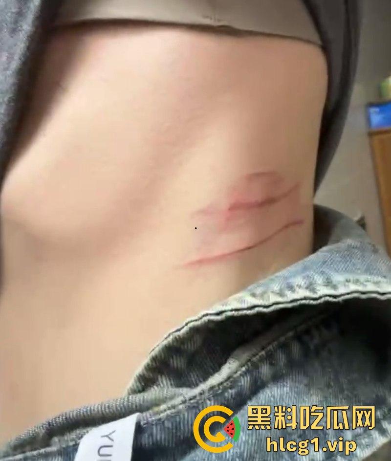 揭东区庵后村家暴男【高浩南】 不仅喜欢出轨还不怕报警 专吃硬的不愧是浩南哥！-6