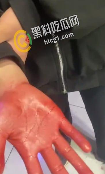 青海西宁 一女孩在酒店里遭多人暴打侮辱 扇耳光割头发 还逼迫女孩脱光全身衣服拍照！-6